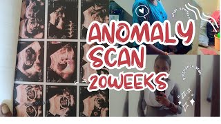 anomaly scan report 20weeks baby gender [upl. by Grossman]