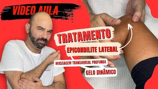 Tratamento para Tendinite no Cotovelo  Epicondilite Lateral  Vídeo Aula [upl. by Eveiveneg]