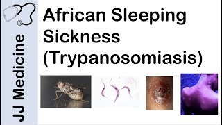 African Sleeping Sickness Trypanosomiasis  Causes Symptoms and Treatment [upl. by Wartow748]