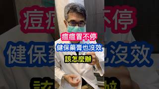 痘痘 冒不停 皮膚科醫師 說😎健保 藥膏 也沒效⁉️ 該怎麼辦❓ 吳仁欽皮膚科診所 A酸 口服A酸 艾克痘 A醇 醫皮痘 痘痘針 粉刺 過氧化苯 殺菌 抗藥性 [upl. by Ocirred]