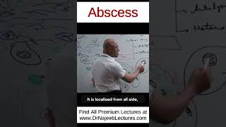 Abscess drnajeeb drnajeeblectures shortvideo youtubeshorts [upl. by Didi612]