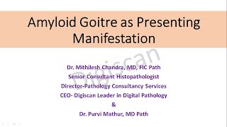 Amyloid Goitre as Presenting Manifestation [upl. by Suzi]