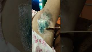 Underarm waxing with Rica waxUnderarm waxing armpit waxwaxing hackshort shorts youtubeshorts [upl. by Ellesij424]