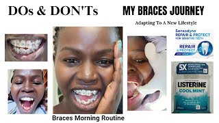 My Braces Morning RoutineAdapting To A New Lifestyle [upl. by Nailij922]