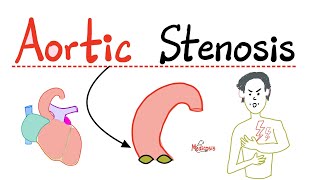 Aortic Stenosis AS  Valvular Heart Disease VHD  Causes Symptoms Diagnosis Treatment Cardio [upl. by Annas428]