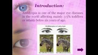 Therapies to cure Amblyopia [upl. by Savihc174]