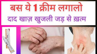 Luliconazole Cream  Luliconazole Cream Luliford  दाद खाज़ खुजली की दवा [upl. by Nuli]