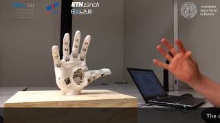 Myoelectric control of a 3D printed prosthetic hand [upl. by Nanon]