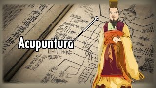 Acupuntura [upl. by Pigeon]