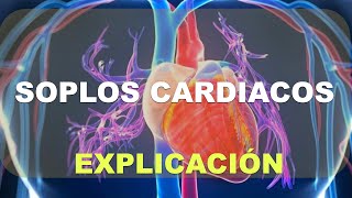 Soplos del corazon soplo cardiaco [upl. by Ttam314]