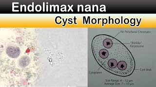 Endolimax nana Cyst Morphology [upl. by Demakis]