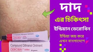 দাদ এর চিকিৎসা।। দাউদ এর চিকিৎসা।। দাদ এর মলম।। ডেরোবিন মলম।। Derobin cream dad ar molom [upl. by Nnaear]