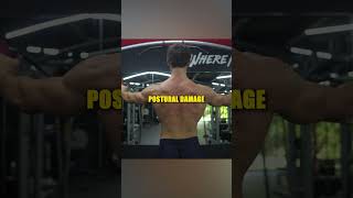 DO THIS Exercise to Improve Posture that makes the SUNKEN CHEST look WORSE [upl. by Battat]