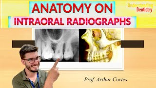 ALL ANATOMICAL LANDMARKS of maxilla and mandible Periapical X Ray and Radiographs Dental Anatomy [upl. by Aerbma]