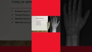 4️⃣ Types of epiphysis 🦴 anatomy anatomylectures osteology medicalstudent [upl. by Auric]