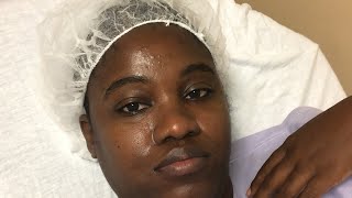 TTC JOURNEY  FIBROIDS REMOVAL SURGERY LUPRON INJECTION [upl. by Gerdeen]