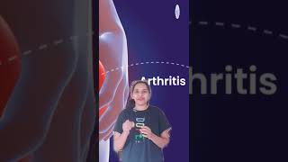 Part2 Rheumatoid arthritis Symptoms and Precautions  health healthylifestyle facts shorts [upl. by Ailegna401]