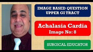 ACHALASIA CARDIA Upper GI Tract Image Based Question [upl. by Glass933]