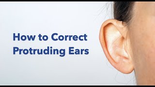 Otoplasty ear pinning surgery explained [upl. by Enivid]