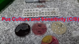 Staphylococcus aureus isolation from Pus Culture and Antibiotics Sensitivity Testing [upl. by Leff]