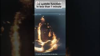 Echo 2D ejection fraction and sytolic LV function Dr Alaa Nasr [upl. by Yatnuahs770]