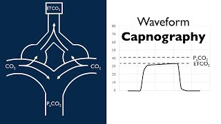 Waveform Capnography  BAVLS [upl. by Alvis]