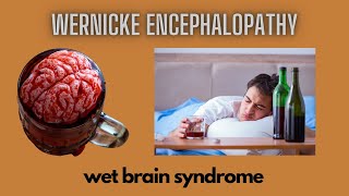 Wernicke Encephalopathy  Wet Brain Syndrome [upl. by Nimajnab]