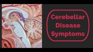 Cerebellar Disease Symptoms [upl. by Esbenshade]