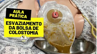 Esvaziamento da bolsa de Colostomia [upl. by Airel658]