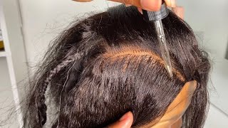 ASMR AGGRESSIVE SCALP SCRATCHING amp SCALP OILING ASMR😴 FALL ASLEEP IN 5MINS😴 [upl. by Ayenat]