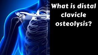 What is distal clavicle osteolysis [upl. by Robbyn993]