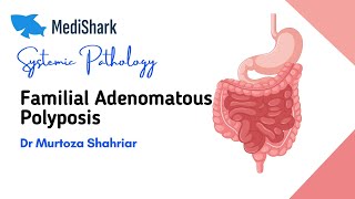 Systemic Pathology Familial Adenomatous Polyposis Dr Murtoza Shahriar [upl. by Braasch318]