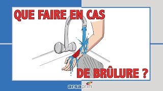 Que faire en cas de brûlure [upl. by Akcirederf]