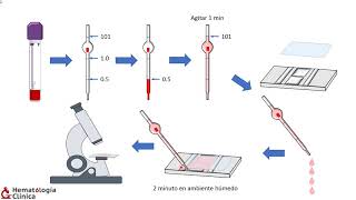 Conteo de eritrocitos en Cámara de Neubauer [upl. by Arinayed535]