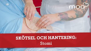 Skötsel och hantering  Stomi [upl. by Innavoeg]