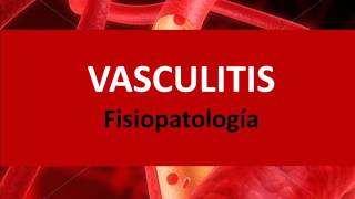 Vasculitis  Fisiopatología [upl. by Ahtimat951]