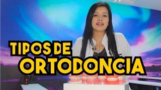 Tipos de BracketsOrtodoncia – Odontología Láser [upl. by Smoht]