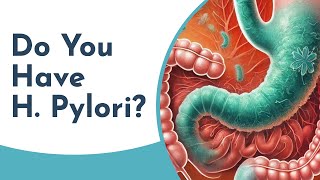 How to Diagnose H Pylori Tests and Procedures Explained [upl. by Dyal]