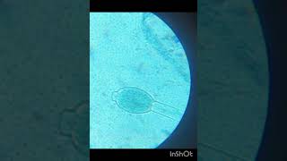 Oogogium of Oedogonium reels shorts algae cbcs wbsu neweducationpolicy2020 botany biology [upl. by Nodle]