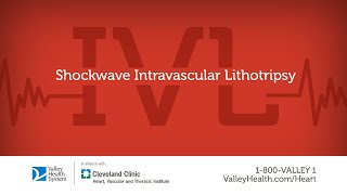 What is Shockwave Intravascular Lithotripsy [upl. by Nahtaoj]