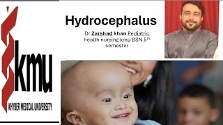 hydrocephalus pediatric health nursing kmu BSN 5th semester [upl. by Ajim]