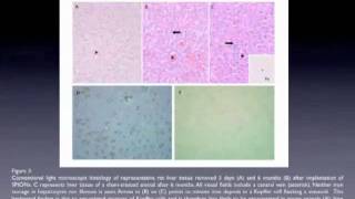 Superparamagnetic iron oxide nanoparticles  Video abstract 23638 [upl. by Yesak]