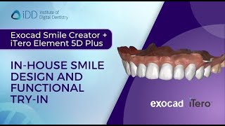 Exocad Smile Creator  iTero Element 5D Plus Inhouse Smile Design and Functional TryIn [upl. by Annawit]