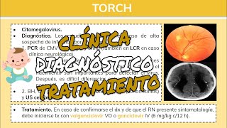 ⚕️🩺 Infecciones Congénitas TORCH RUBEOLA CITOMEGALOVIRUS HERPES SIMPLE VARICELA [upl. by Lili]