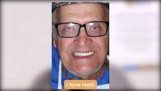 Davids Testimonial  SunBrite Dental [upl. by Tad]