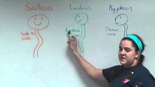 Scoliosis Lordosis and Kyphosis [upl. by Elisabetta345]