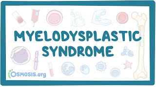 Myelodysplastic syndromes  causes symptoms diagnosis treatment pathology [upl. by Annahsed]