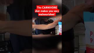 The CARNIVORE diet makes you very malnourished carnivore keto [upl. by Owain]