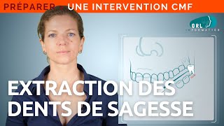 Extraction des dents de sagesse  Information patient ORL [upl. by Nace]