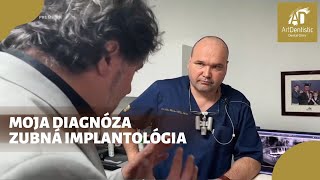 Moja diagnóza  Zubná implantológia umenie i kumšt [upl. by Conan]